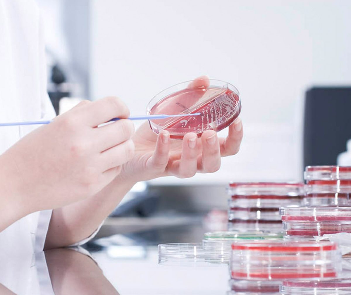 Close-up of a woman's hands probing a bacteria culture in a petri dish in a research lab. In the backgrounds, more petri dishes are visible.